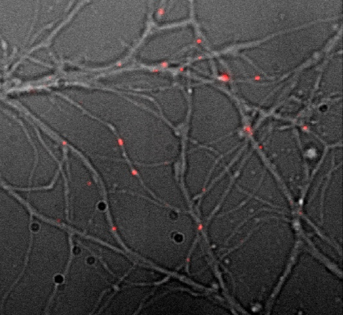 Nanodiamants dans des neurones