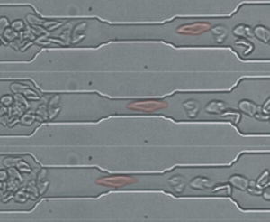 micro fluidique globule rouge